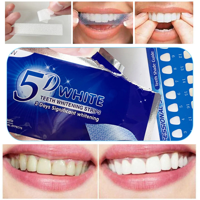 Adesivo com gel - clareador de dente