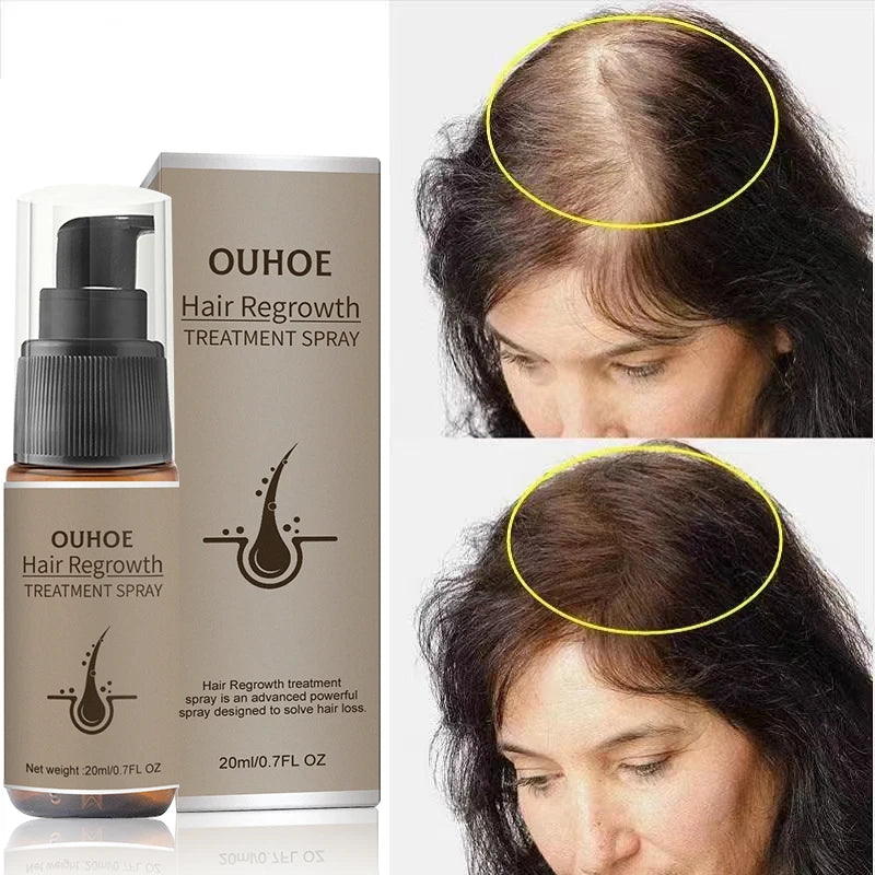 Spray de crescimento do cabelo - o único que funciona de verdade