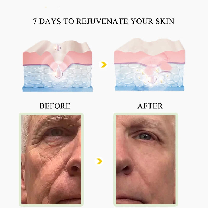 Anti-rugas creme facial - rejuvenescedor